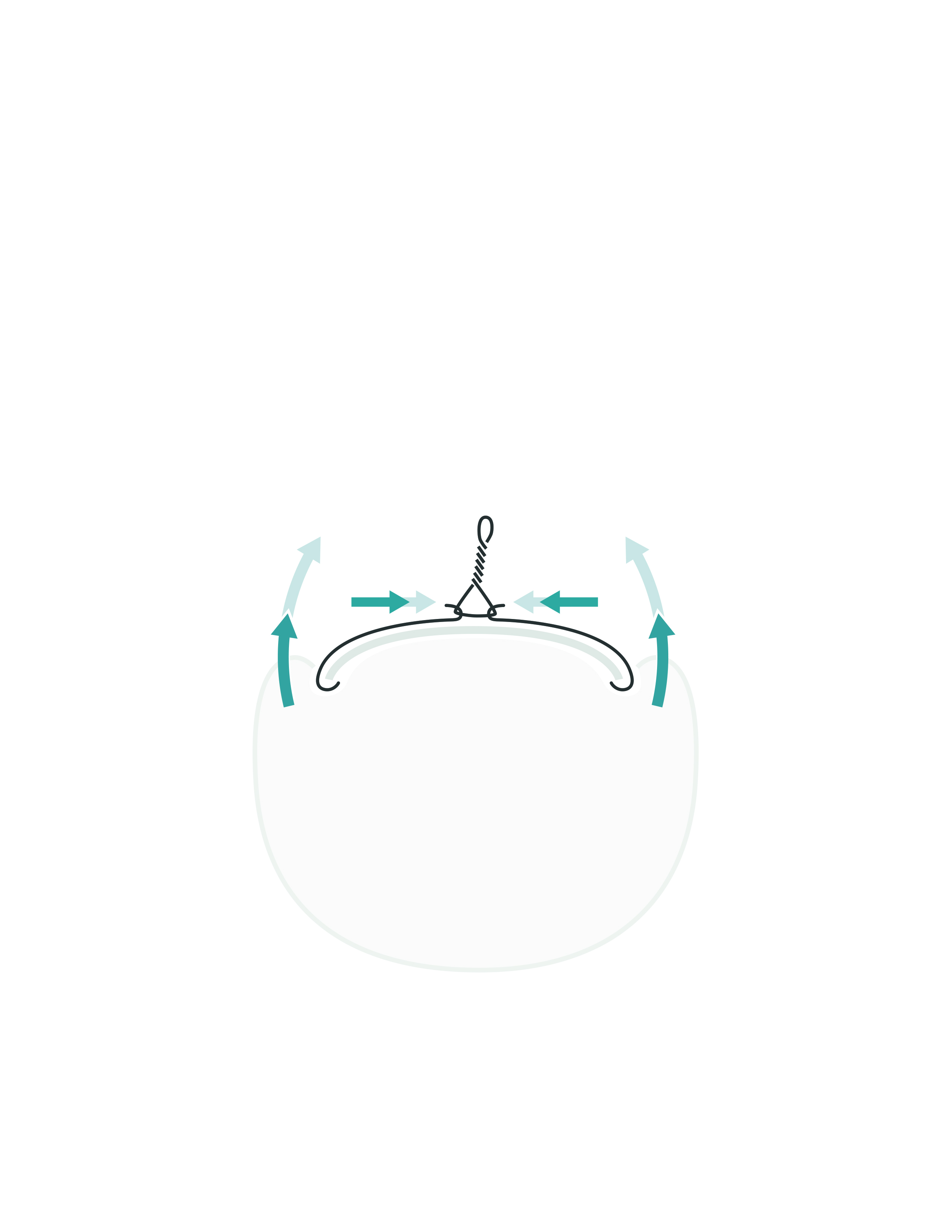 3TO-Spange® small/Kinder mit 3TO-loop, 5 Stück